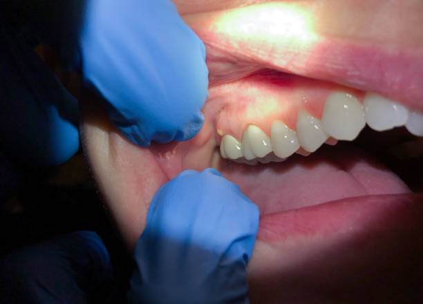 Best Emergency Root Canal Treatment in Franklin Center, NJ