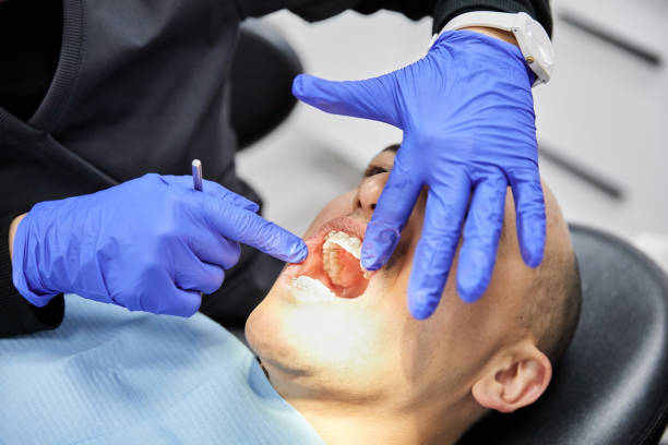 Best Emergency Wisdom Teeth Removal in Franklin Center, NJ