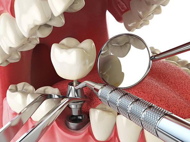 Best Emergency Treatment for Toothache in Franklin Center, NJ